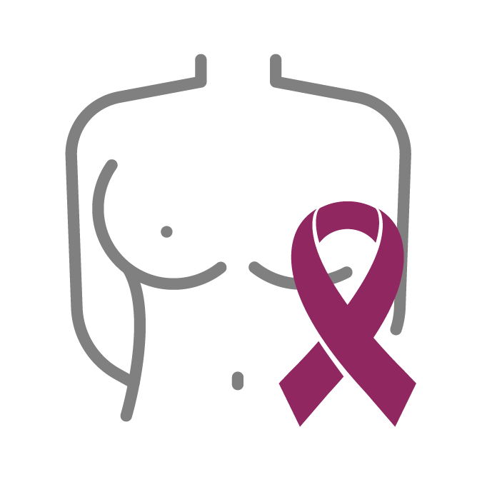 what is Breast Cancer