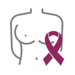 what is Breast Cancer