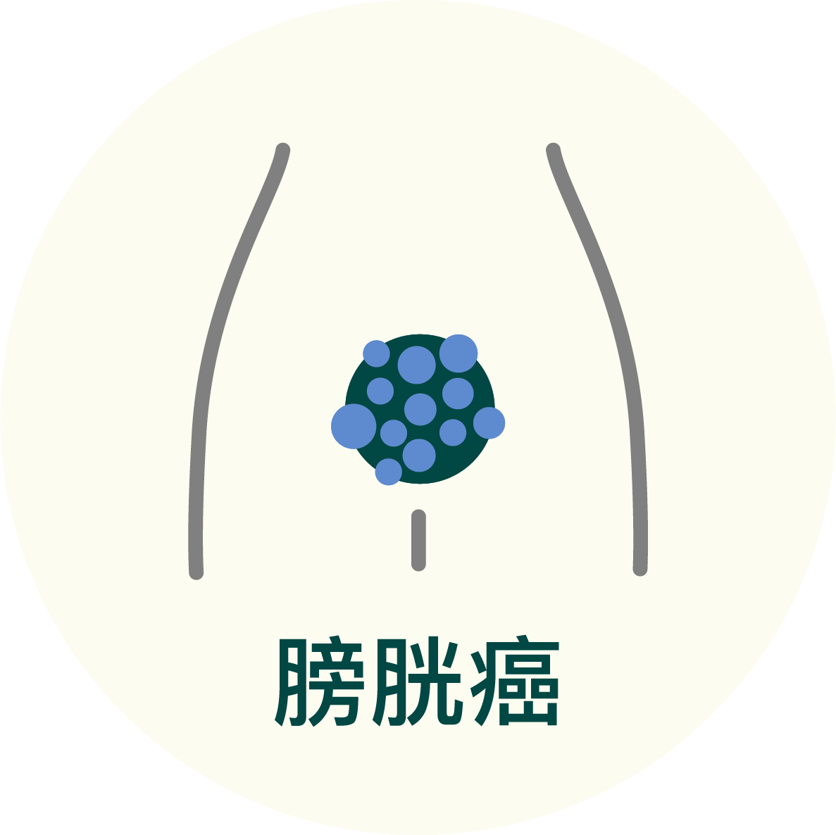 膀胱癌