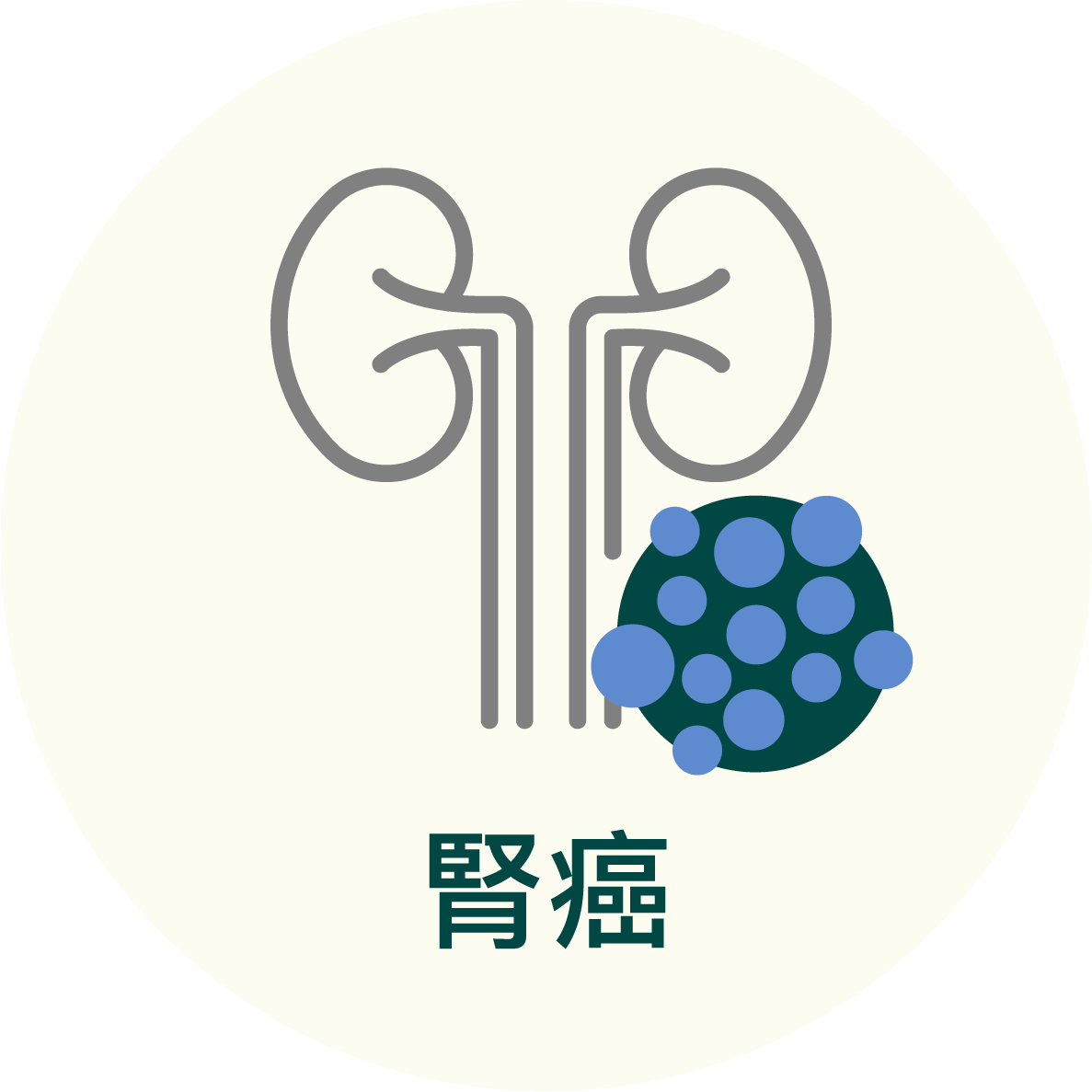 腎癌