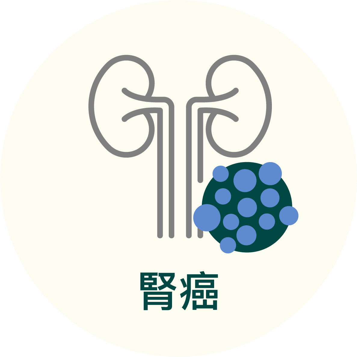 腎癌