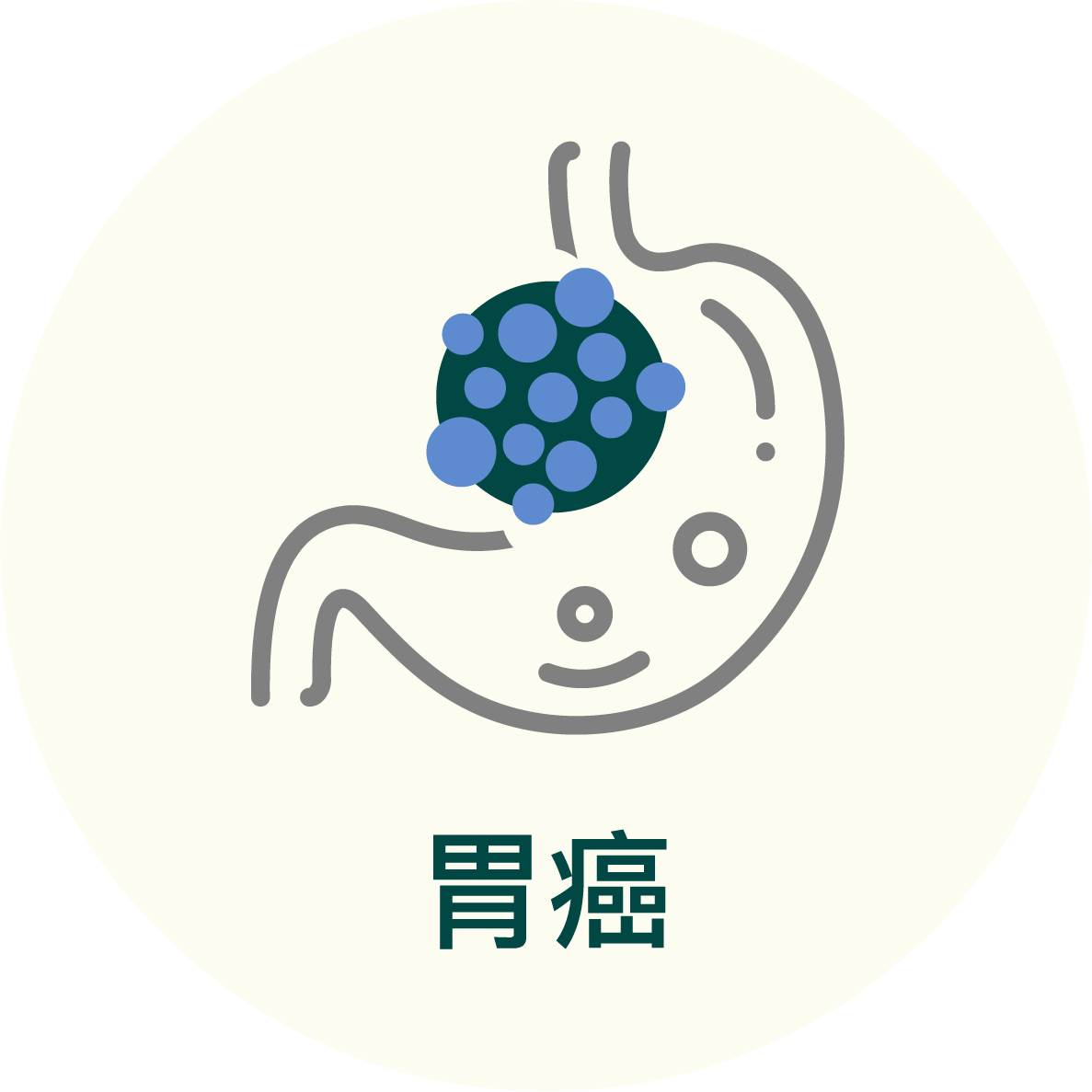 胃癌