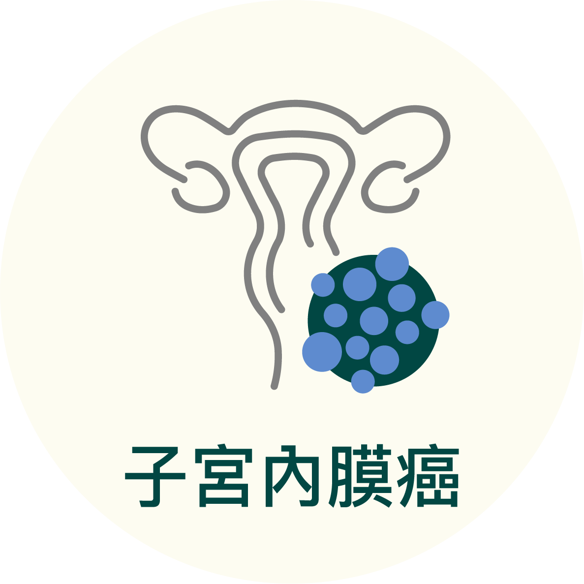子宮內膜癌