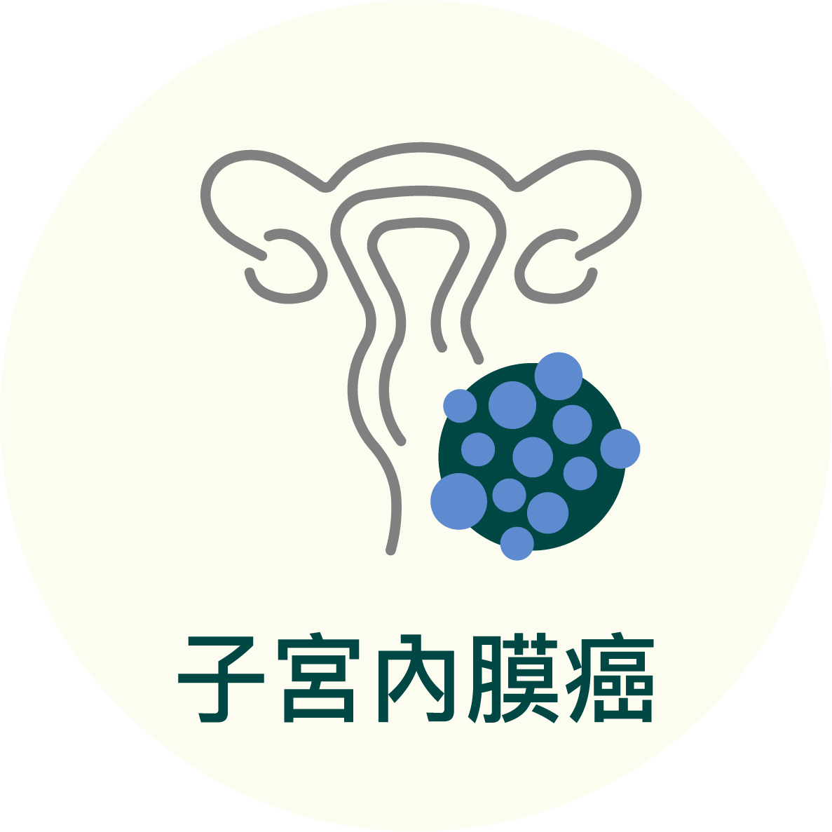 子宮內膜癌
