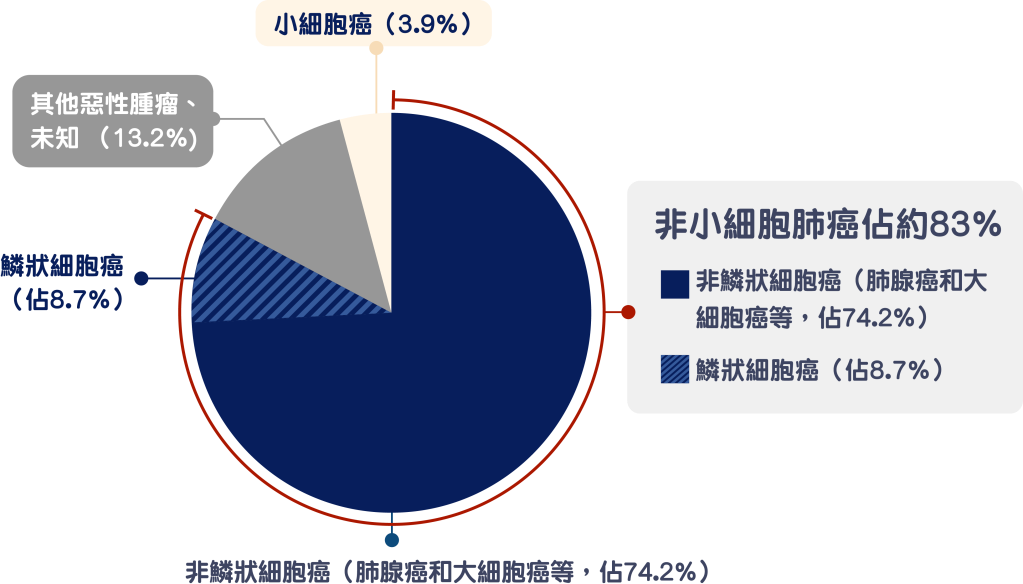 小細胞癌（3.9%）

其他惡性腫瘤、未知（13.2%）

鱗狀細胞癌（佔8.7%）

非鱗狀細胞癌（肺腺癌和大細胞癌等，佔74.2%）

非小細胞肺癌佔約83％
當中非鱗狀細胞癌（肺腺癌和大細胞癌等，佔74.2%），鱗狀細胞癌（佔8.7％）


