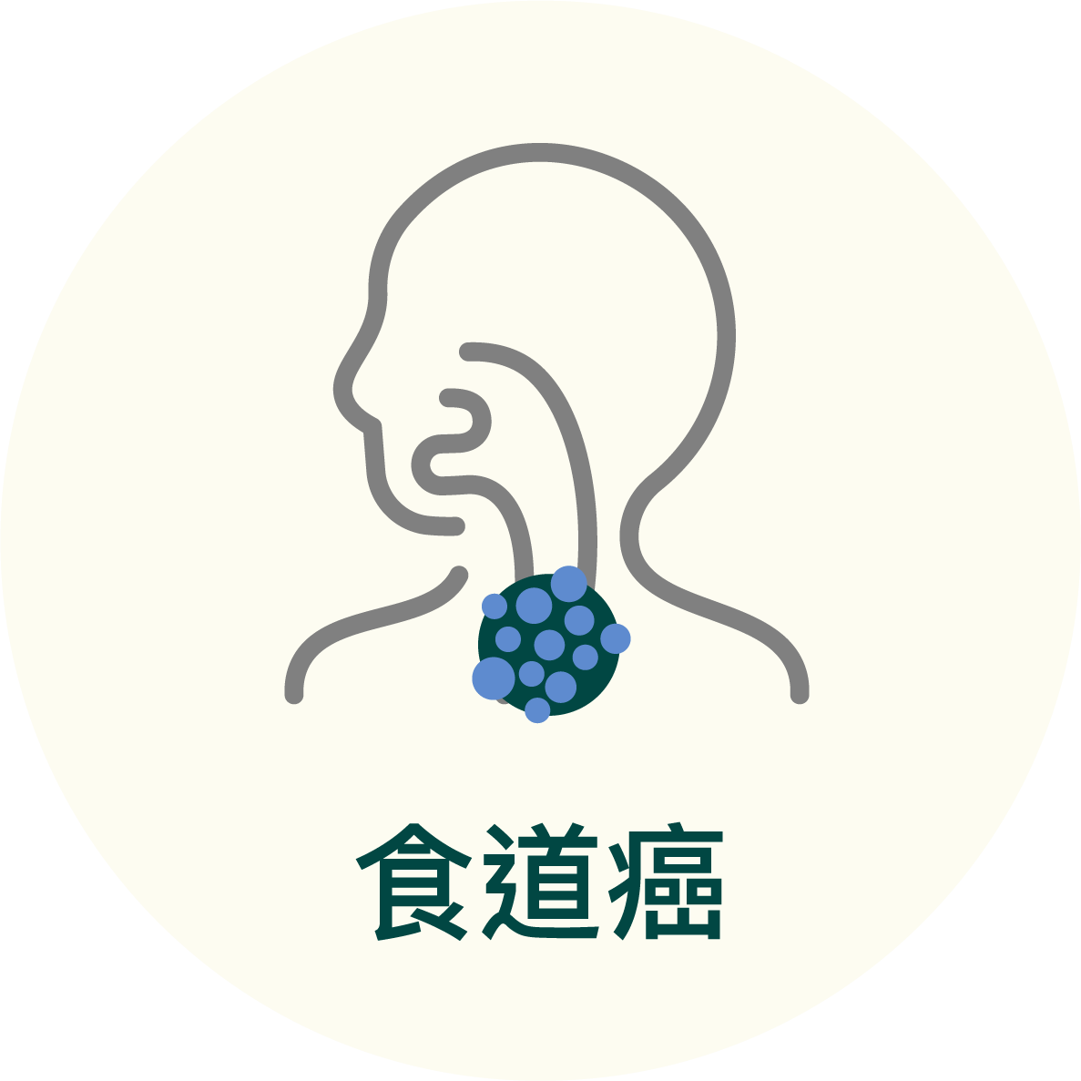 食道癌
