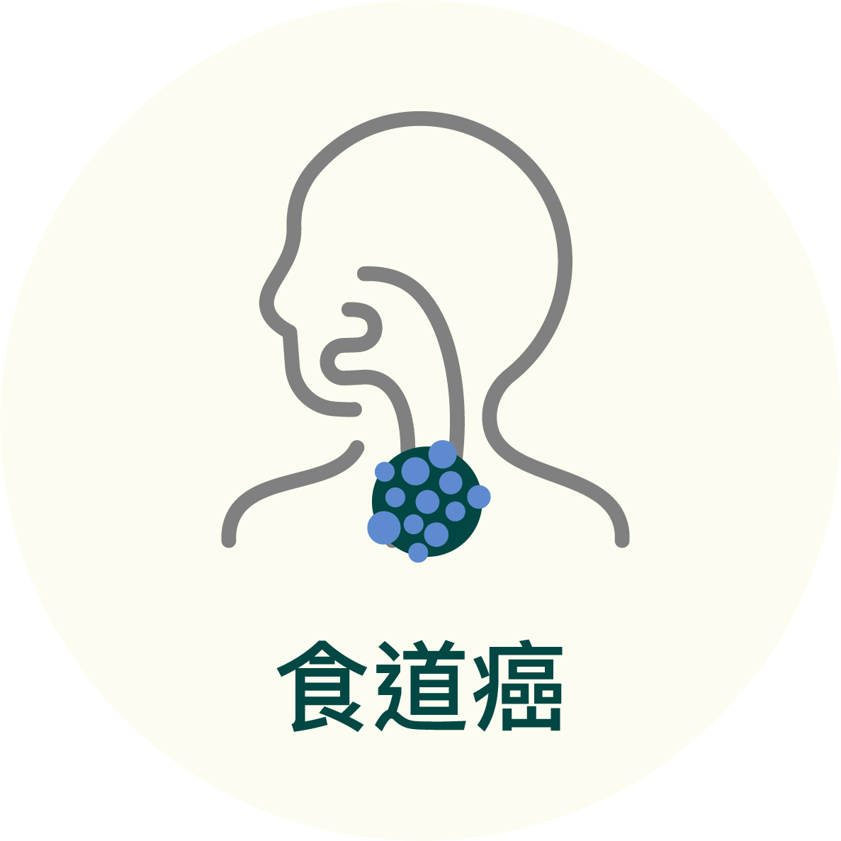 食道癌
