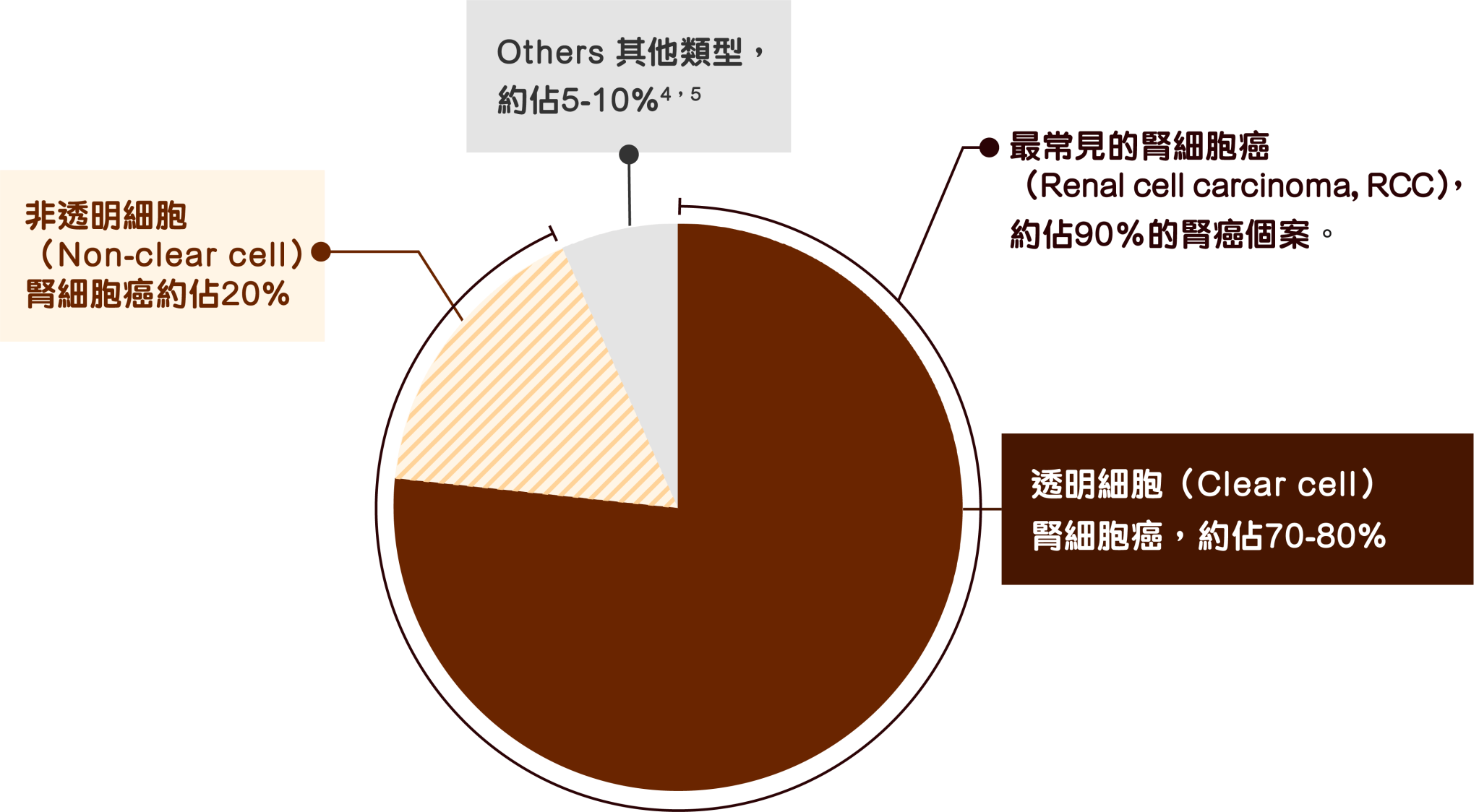 移形細胞癌(Transitional
cell carcinoma, TCC)
腎盂長出的腎癌,約佔所有腎癌的5-10%
最常見的腎細胞癌
(Renal cell carcinoma, RCC) •
約佔90%的腎癌個案,故此腎癌一般也指腎細胞癌;
而腎細胞癌主要類型有:
透明細胞(Clear cell)
腎細胞癌,約佔70-80%
非透明細胞(Non-clear cell)
腎細胞癌約佔20%
• 乳頭狀腎細胞癌
(papillary renal cell carcinoma)
01510-15%
• 嫌色腎細胞癌則約佔5%
(chromophobe carcinoma)
其他較罕見腎癌:腎肉瘤、威爾姆斯瘤(Wilm'stumor,又稱腎母細胞癌nephroblastoma)